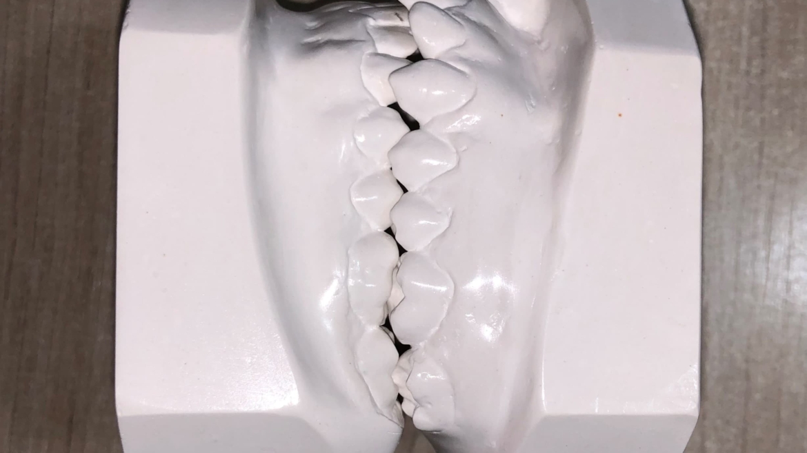 Modelos de estudo das arcadas dentárias