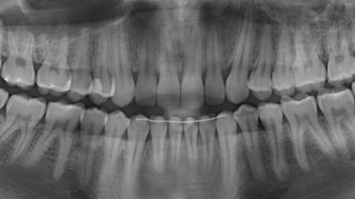 Radiografia Panorâmica