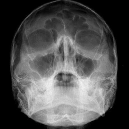 Radiografias da Face